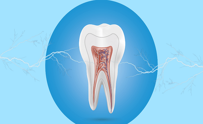Tooth Sensitivity Solutions